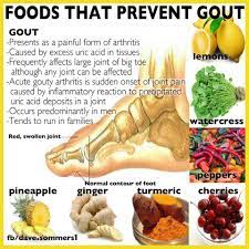 Health Me Up - Read About: High Uric Acid Treatment: Natural Ways To Fight  Gout Http://Toi.in/Im18Gb Follow Health Me Up On Twitter Http://Ow.ly/Srm5X  On Google+Http://Tinyurl.com/Kxegbd2 Share If You Like | Facebook