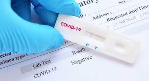 Komplettpaket testkit mit 25 sars cov2 einzeltests inklusive psa (schutzausrüstung), anleitung und dokumentation. 80 Of Coronavirus Test Kits Gifted To Czechs By China Faulty Taiwan News 2020 03 25