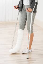 Broken Bones And Damaged Joints And Accidents Blumenshine Law