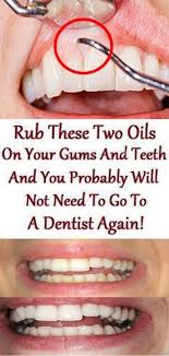 Another benefit of gum care is that it allows your child to get used to dental care in general. Rub These Two Oils On Your Teeth And Gums And You No Need To Visit A Dentist Again Gumcare Gum Care Tea Tree Dentist Gum Care Gum