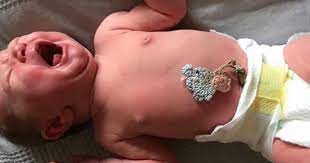 gobek bakimi cocuk doktoru bursa uzm dr gul guner nar