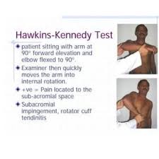 Image result for Hawkins Test