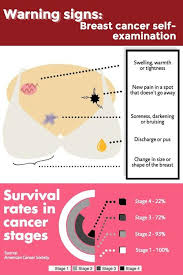 Learn the signs and symptoms of breast cancer and talk to your doctor immediately if you experience the most common symptom is a lump in your breast or armpit. Infographic Warning Signs Of Breast Cancer Multimedia Iowastatedaily Com
