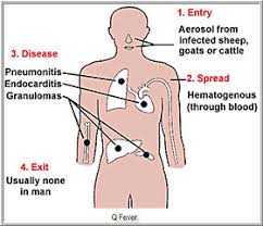 Image result for Q Fever