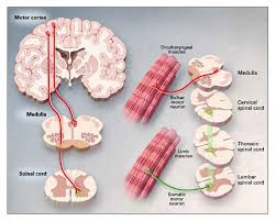 Amyotrophic lateral sclerosis (als) is a progressive neurodegenerative disease that affects nerve cells in the brain and the spinal cord. Amyotrophic Lateral Sclerosis Nejm