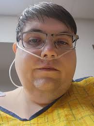 Gastric sleeve surgery recovery progress