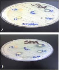 Image result for Schizozygia coffaeoides