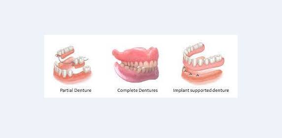 Dentures product image