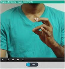 Image result for Rapid Alternating Movements