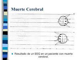 La aparente ausencia de función cerebral no es suficiente; Electroencefalograma Definicion La Electroencefalografia Es Una Tecnica Que Permite Registrar La Actividad Electrica Del Cerebro Por Medio De Electrodos Ppt Descargar