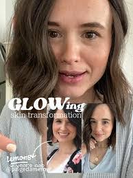 Alyssa Kozak's Instagram, Twitter & Facebook