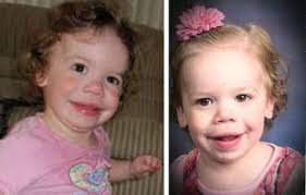 7 several courts, including state courts, have applied the quarles exception in situations where the police are attempting to find and/or protect a possible victim, as in this case, as opposed to a police officer or members of the public in general. Williams Syndrome American Association For Pediatric Ophthalmology And Strabismus