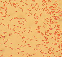 They may also cause urinary tract infections. Pathogenic Escherichia Coli Wikipedia