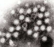 Norovirus is a very contagious virus that causes vomiting and diarrhea. Norovirus Wikipedia