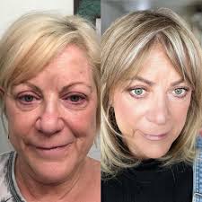 5 months to a new face with Pomifera products