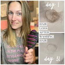 What can I do to reduce hair loss?