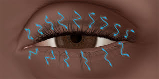 Que Es Un Espasmo De Parpado O Un Temblor De Parpado American Academy Of Ophthalmology