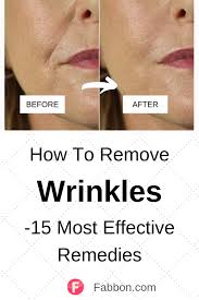 15 Most Effective Home Remedies For Wrinkles 2020 Home Remedies For Wrinkles Anti Aging Remedies Wrinkles