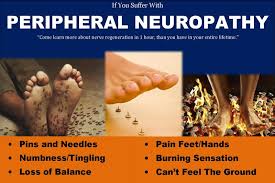 Image result for Peripheral Neuropathy