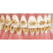We did not find results for: 24k Gold Loose Mbt 022 Brackets Ea 27020