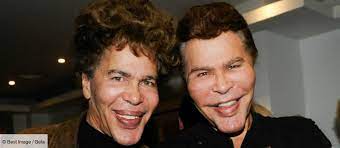 Igor Et Grichka Bogdanoff Ont Ils Fait De La Chirurgie Esthetique Leur Reponse Laisse Perplexe Gala