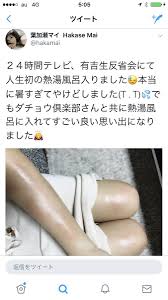 24時間テレビ 葉加瀬マイが熱湯風呂で火傷 関係者が火消しか にゅーすよ