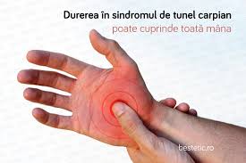 Ai simtit pana acum o amorteala in degetele de la mana dreapta? Durere In Mana Slabiciune Amorteli Furnicaturi Semnificatie Si Tratament