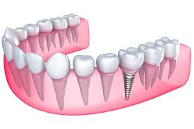 Low cost canine dental care near me. Best Dental Clinic In Abu Dhabi Best Dental Care Orthodontics In Abu Dhabi
