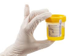 Image result for Clean Catch Urine Collection