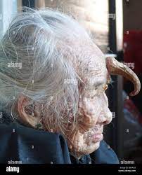 HORNY OLD LADY A 95 year old woman from Zhanjiang, south China, has  sprouted a 12 centimetre long horn on her forehead. The Stock Photo - Alamy