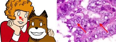 A historical note am j surg pathol. Endocrine Lectures 5 And 6 Thyroid Path Wang Flashcards Quizlet