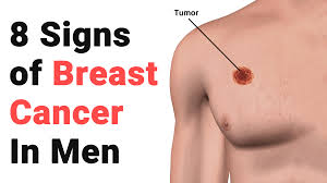 It is hard to diagnose stomach cancer in its. 8 Signs Of Breast Cancer In Men