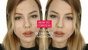 how to conceal your blemishes and acne