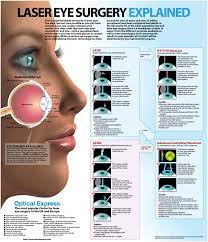 Why Should I Consider Laser Eye Surgery Lasik Eye Surgery Laser Eye Surgery Eye Surgery