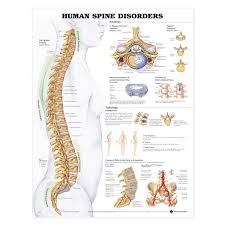 Human Spine Disorders Anatomical Chart 2nd Edition