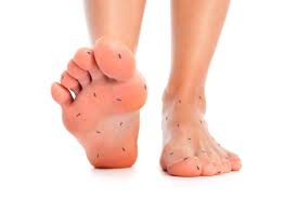 We did not find results for: Diabetes And Feet Diabetic Neuropathy Symptoms