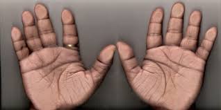 Maybe you would like to learn more about one of these? Marriage Line On Palm Palm Reading Love Marriage Lines In Palmistry