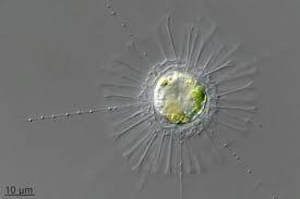 Image result for Raphidiocystis