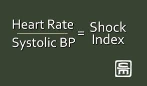 Shock Index: a more sophisticated determinant of hypovolemic shock - Crisis  Medicine