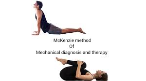 Image result for McKenzie Method