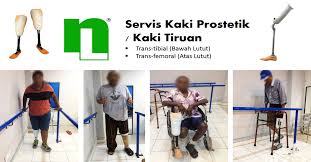 Kaki palsu in a sentence and translation of kaki palsu in english dictionary with audio pronunciation by dictionarist.com. Servis Kaki Prostetik Kaki Tiruan Kuala Lumpur Kl Cheras Selangor Malaysia Supplier Suppliers Supplies Supply Servis Kaki Palsu Neolee Rehab Supply Sdn Bhd