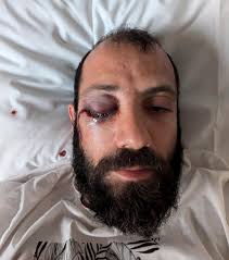 Amir (36) slått ned på lekeplassen