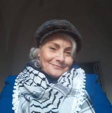 DERMATITE ATOPICA E MICROBIOTA INTESTINALE: CHE RUOLO HANNO I PROBIOTICI  NELLA PREVENZIONE E NEL TRATTAMENTO DELLE MALATTIE DERMATOLOGICHE? . La  dermatite atopica (AD) è un problema di salute pubblica e sta aumentando