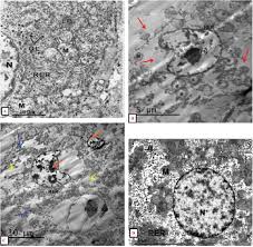 Transmission electron microscope images color. Color Online Transmission Electron Microscopy Of Liver Tissues From Download Scientific Diagram