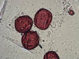 Image result for Anthospermum whyteanum