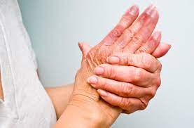 The trees are bare and frost in the air.(autumn). Itchy Red Or Purple Bumps From The Cold Chilblains Could Be The Culprit Health Essentials From Cleveland Clinic