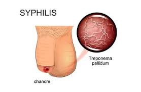 Image result for penis mycosis symptoms