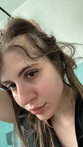 Hello after Radiation how long did it take for you to feel normal again