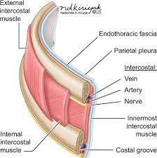 Rib cage diagram with organs. Traumatic Rib Injury Patterns Imaging Pitfalls Complications And Treatment Radiographics