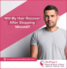 Minoxidil Is An Fda Approved Medication For Male And Female Pattern Hair Loss It Helps To Open Potassi Skin And Hair Clinic Female Pattern Hair Loss Minoxidil